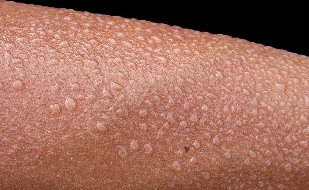 Slaap en transpiratie